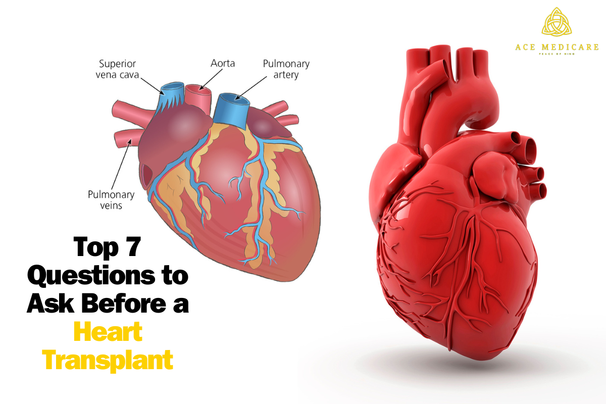 Top 7 Questions to Ask Before a Heart Transplant